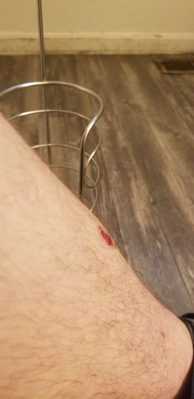 (Irl update) fell through the ceiling)